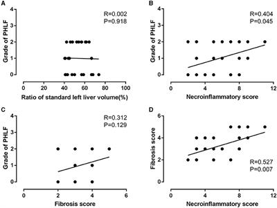 Intraoperative Indocyanine Green Retention Test of Left Hemiliver in Decision-Making for Patients With Hepatocellular Carcinoma Undergoing Right Hepatectomy